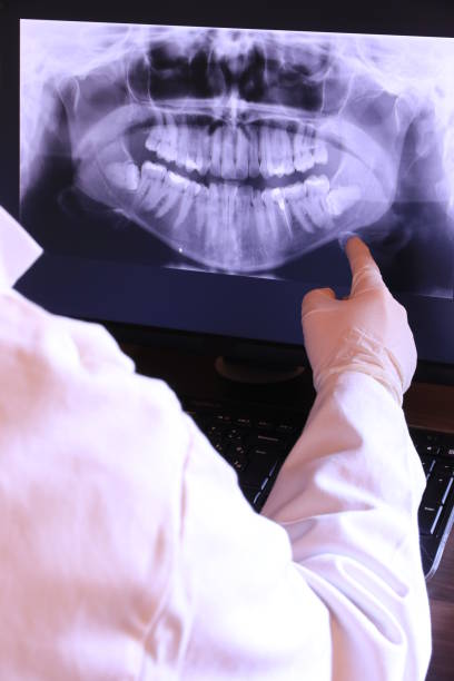Best Knocked-Out Tooth (Avulsed Tooth) Treatment in Hoffman Estates, IL